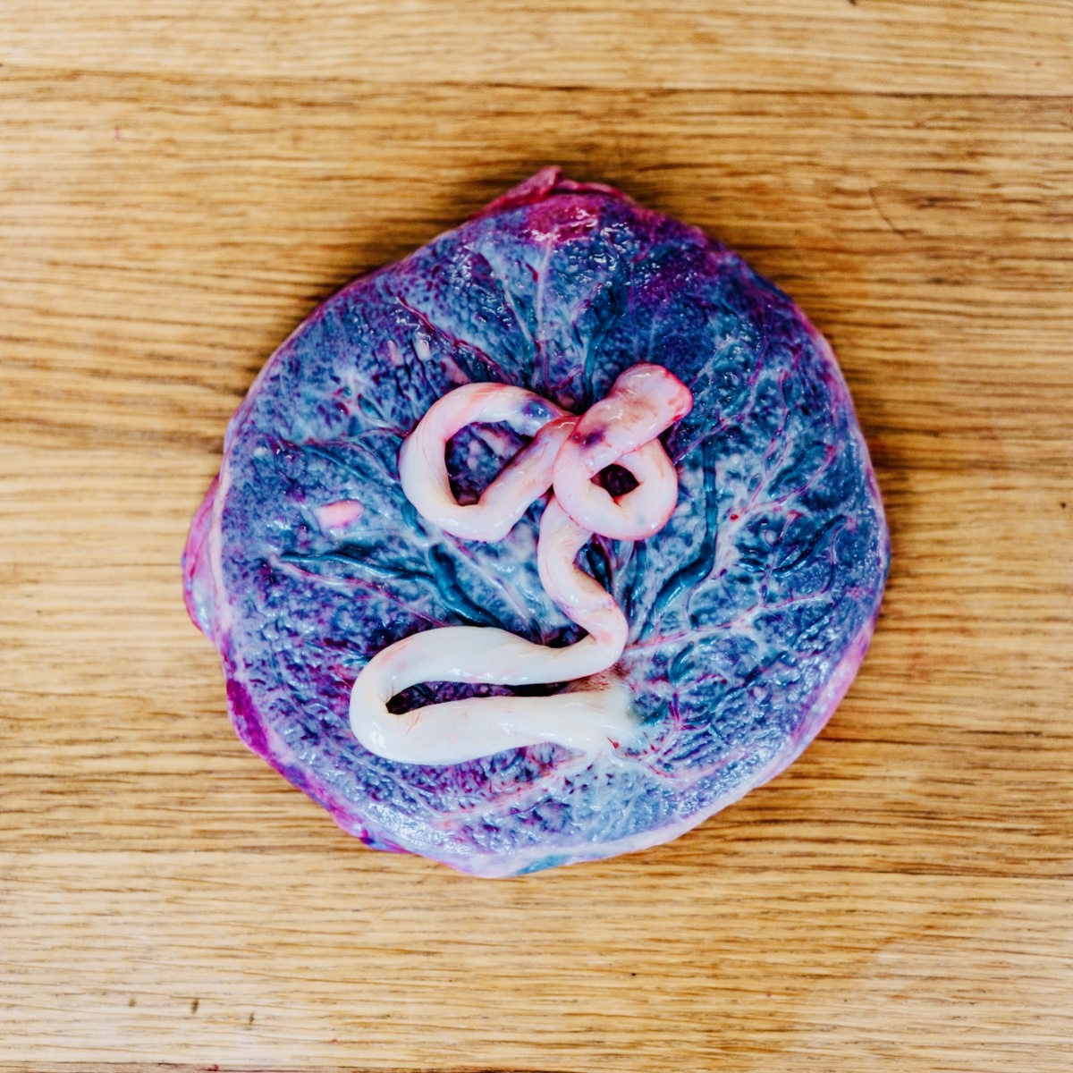 Zpracování placenty